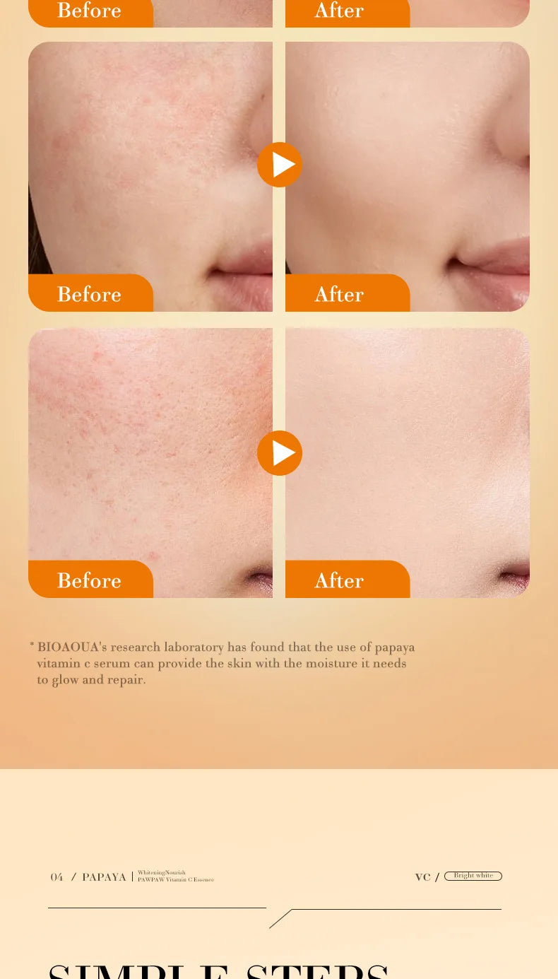 VC Brightening Serum Improve Dullness Remove Dark Spots